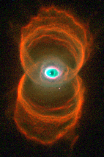 MyCn18: An Hourglass Nebula