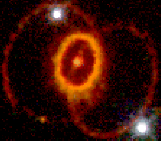 The Mysterious Rings of Supernova 1987a