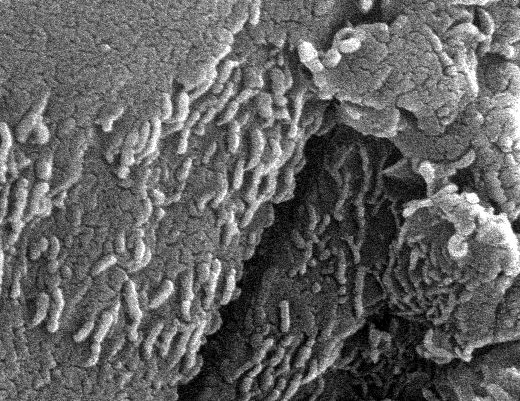 Early Microscopic Life on Mars?