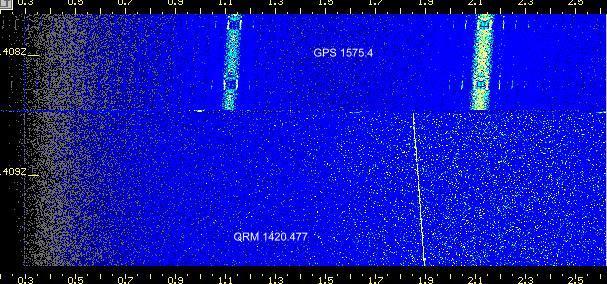 Anomal'nyi signal SETI