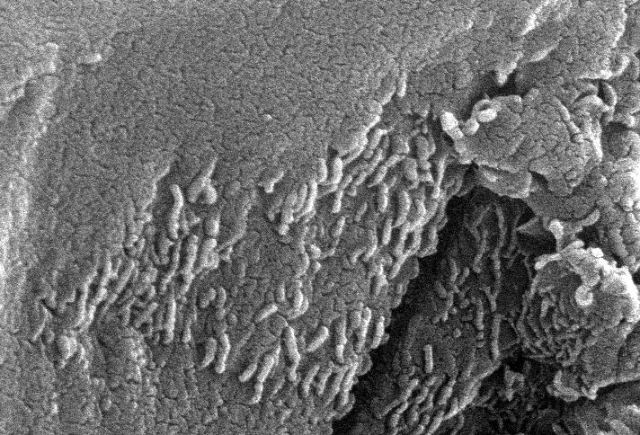 Drevnyaya mikroskopicheskaya zhizn' na Marse?